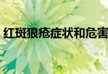 红斑狼疮症状和危害（红斑狼疮有哪些症状）