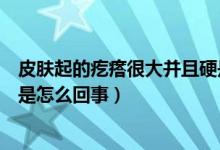 皮肤起的疙瘩很大并且硬是咋回事（皮肤上长疙瘩凸起很硬是怎么回事）