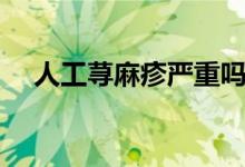 人工荨麻疹严重吗（人工荨麻疹严重吗）