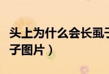 头上为什么会长虱子视频（头上为什么会长虱子图片）