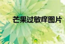 芒果过敏痒图片（芒果过敏痒怎么办）