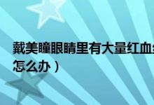 戴美瞳眼睛里有大量红血丝怎么办（戴美瞳眼球周围红血丝怎么办）