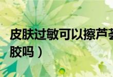 皮肤过敏可以擦芦荟胶（皮肤过敏可以擦芦荟胶吗）