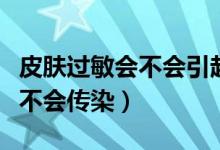 皮肤过敏会不会引起白细胞升高（皮肤过敏会不会传染）