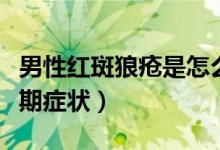 男性红斑狼疮是怎么引起的（红斑狼疮男性早期症状）