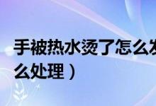 手被热水烫了怎么发朋友圈（手被热水烫了怎么处理）