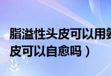 脂溢性头皮可以用氨基酸洗发水吗（脂溢性头皮可以自愈吗）