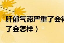 肝郁气滞严重了会得抑郁症吗（肝郁气滞严重了会怎样）