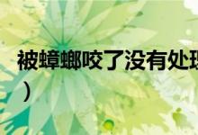 被蟑螂咬了没有处理有事吗（被蟑螂咬怎么办）