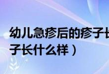 幼儿急疹后的疹子长什么样（幼儿急疹出的疹子长什么样）