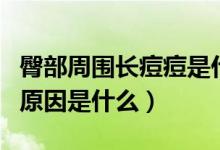 臀部周围长痘痘是什么原因（臀部上长痘痘的原因是什么）