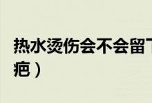 热水烫伤会不会留下疤痕（热水烫伤会不会留疤）