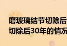 磨玻璃结节切除后30年存活率（磨玻璃结节切除后30年的情况）